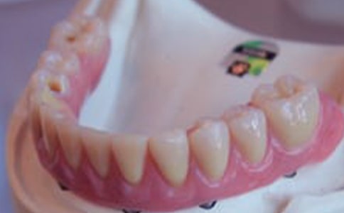 早上起床牙齦出血是怎么回事呢