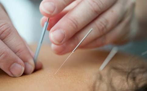 中醫(yī)針灸的原理是什么