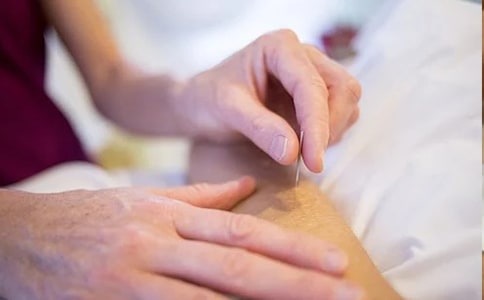 關(guān)于針灸的針灸推拿作文