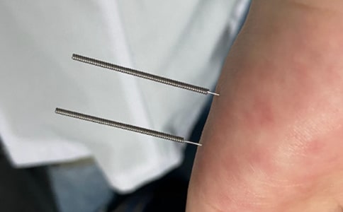 針灸科工作計(jì)劃